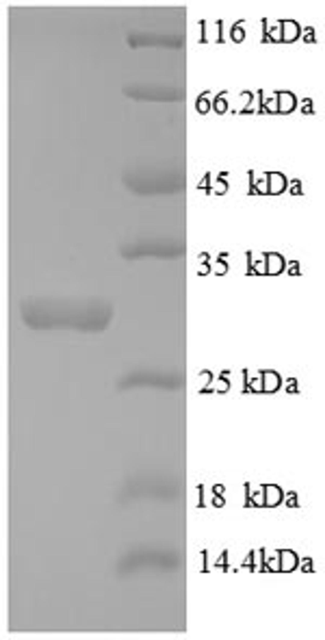 (Tris-Glycine gel) Discontinuous SDS-PAGE (reduced) with 5% enrichment gel and 15% separation gel.