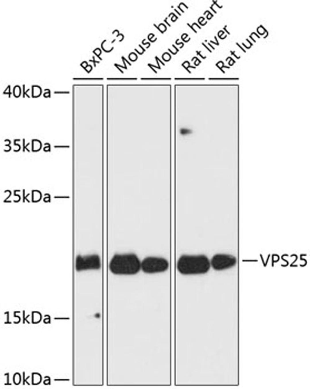 Western blot - VPS25 antibody (A13132)