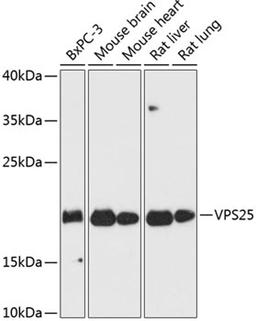 Western blot - VPS25 antibody (A13132)