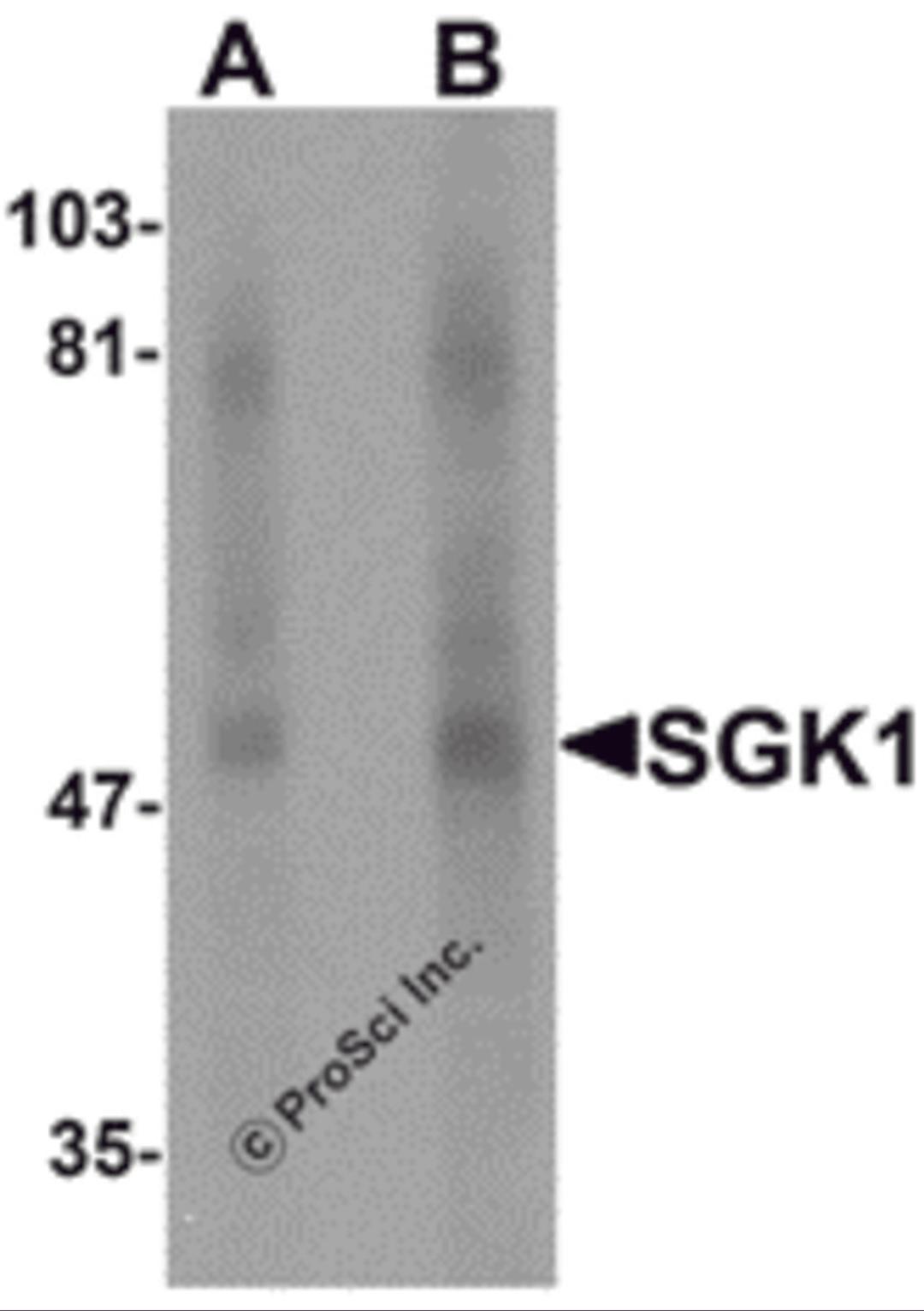 Western blot analysis of SGK1 in human stomach tissue lysate with SGK1 antibody at (A) 1 and (B) 2 μg/mL.