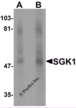 Western blot analysis of SGK1 in human stomach tissue lysate with SGK1 antibody at (A) 1 and (B) 2 μg/mL.
