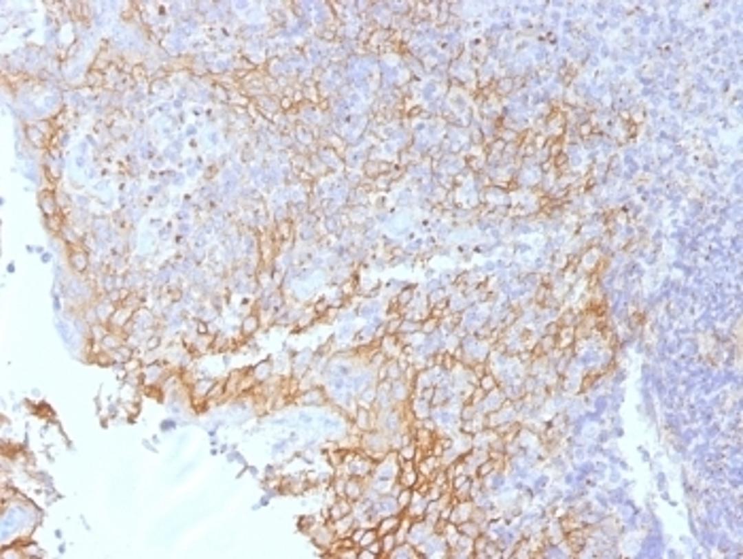 IHC testing of FFPE human tonsil tissue with Beta Catenin antibody (clone 5H10). Required HIER: boil tissue sections in 10mM Tris with 1mM EDTA, pH 9.0, for 10-20 min.