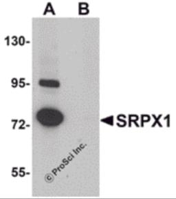 Western blot analysis of SRPX1 in SK-N-SH cell lysate with SRPX1 antibody at 0.25 &#956;g/mL in (A) the absence and (B) the presence of blocking peptide.