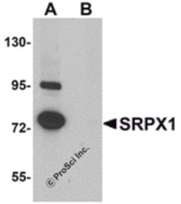 Western blot analysis of SRPX1 in SK-N-SH cell lysate with SRPX1 antibody at 0.25 μg/mL in (A) the absence and (B) the presence of blocking peptide.