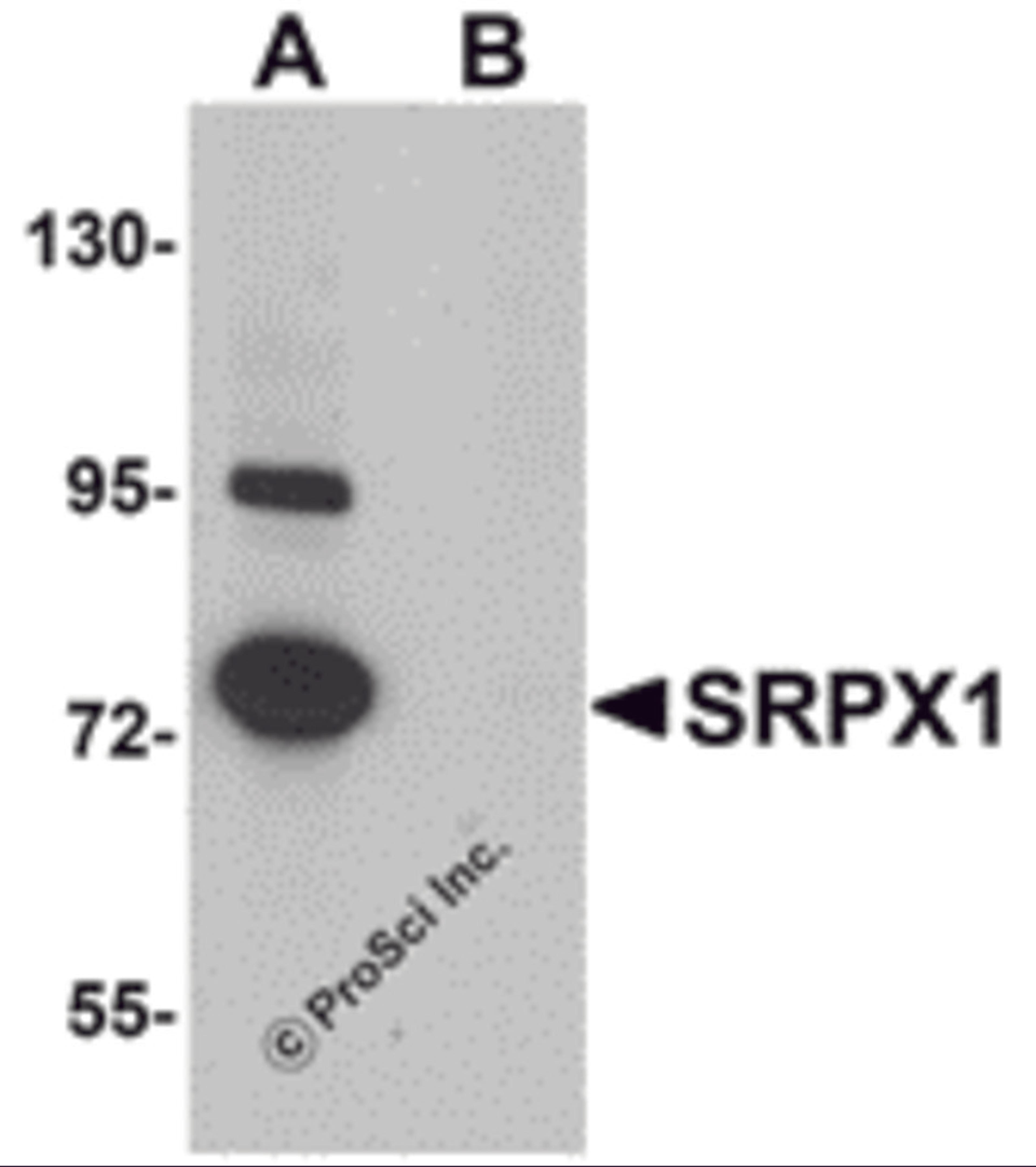 Western blot analysis of SRPX1 in SK-N-SH cell lysate with SRPX1 antibody at 0.25 μg/mL in (A) the absence and (B) the presence of blocking peptide.