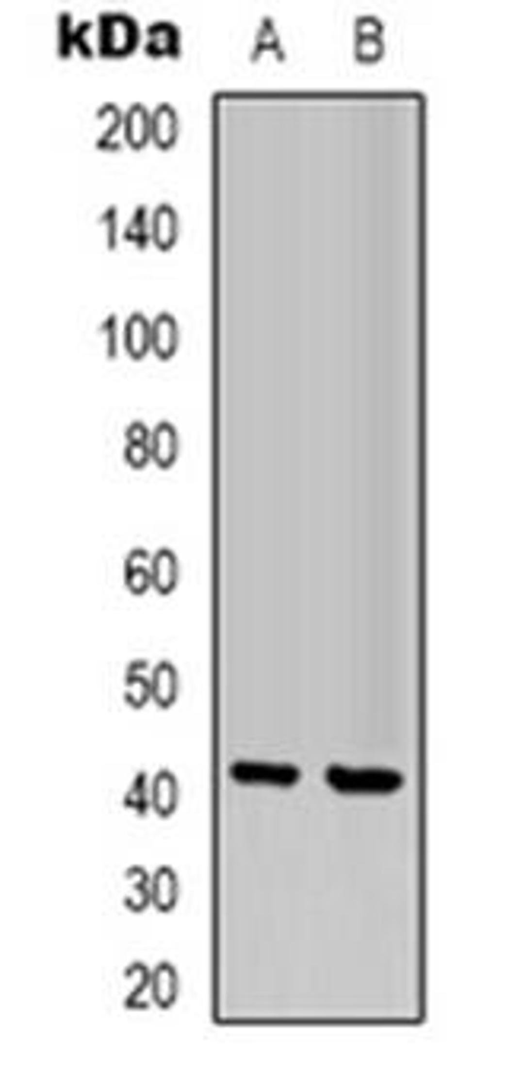 Western blot analysis of NBPF5 expression in Jurkat (Lane 1), human brain (Lane 2) whole cell lysates using NBPF5P antibody