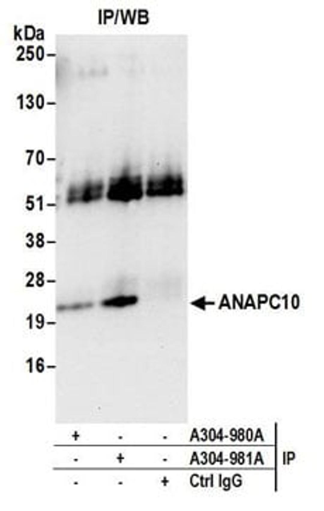 Detection of human ANAPC10 by western blot of immunoprecipitates.