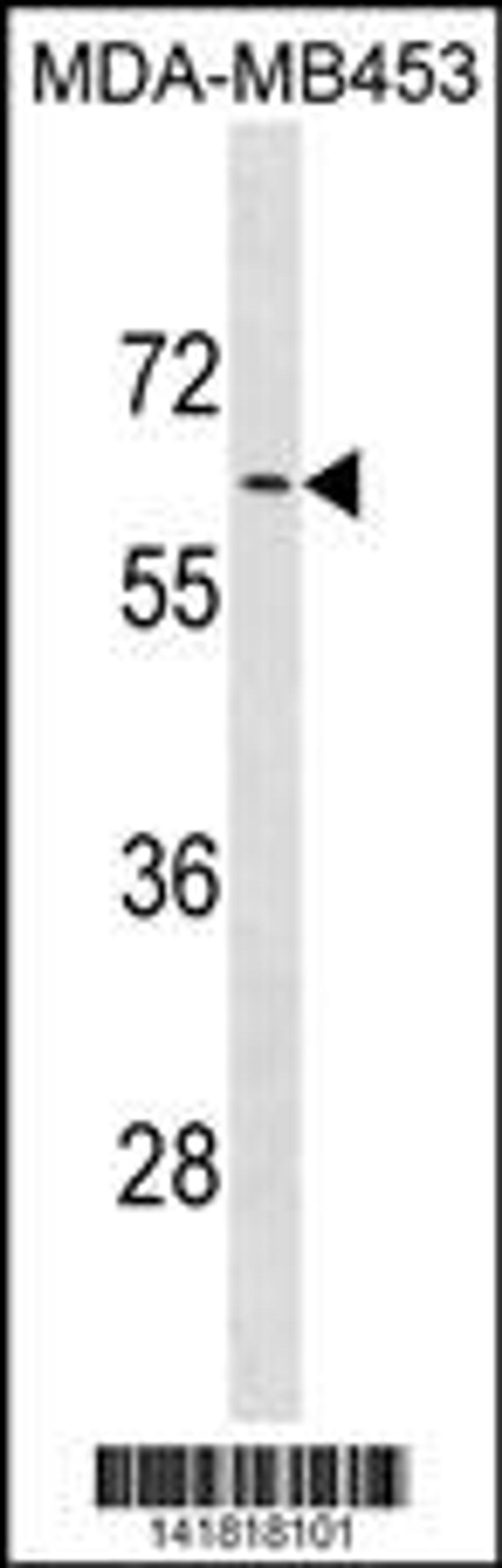 Western blot analysis in MDA-MB453 cell line lysates (35ug/lane).