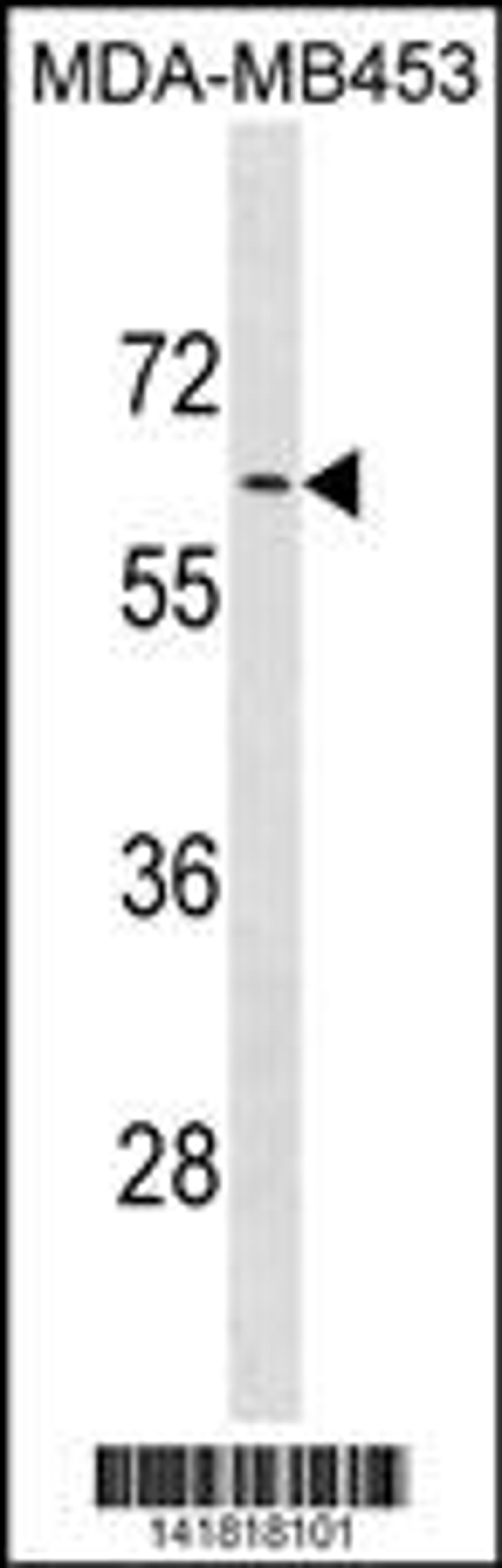 Western blot analysis in MDA-MB453 cell line lysates (35ug/lane).