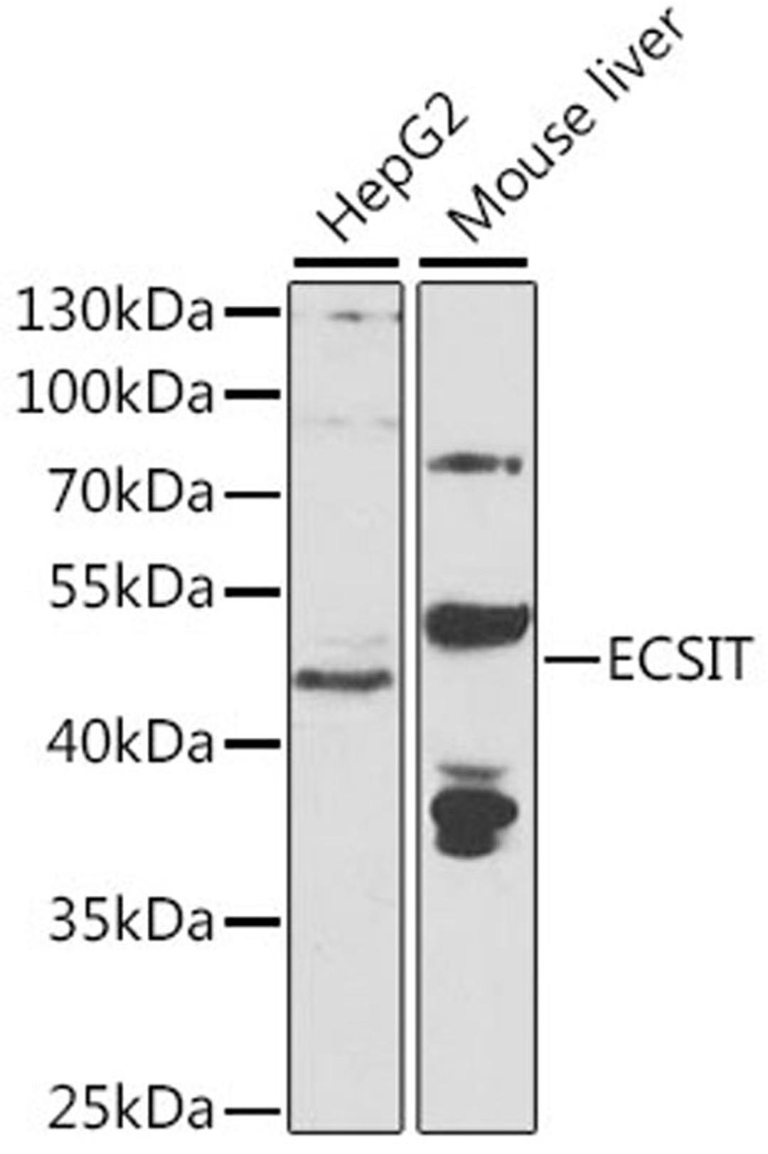 Western blot - ECSIT antibody (A7804)