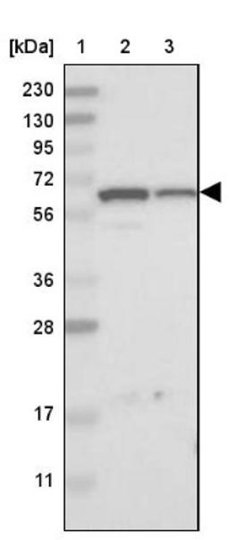 Western Blot: AER61 Antibody [NBP1-90224] - Lane 1: Marker [kDa] 230, 130, 95, 72, 56, 36, 28, 17, 11<br/>Lane 2: Human cell line RT-4<br/>Lane 3: Human cell line U-251MG sp