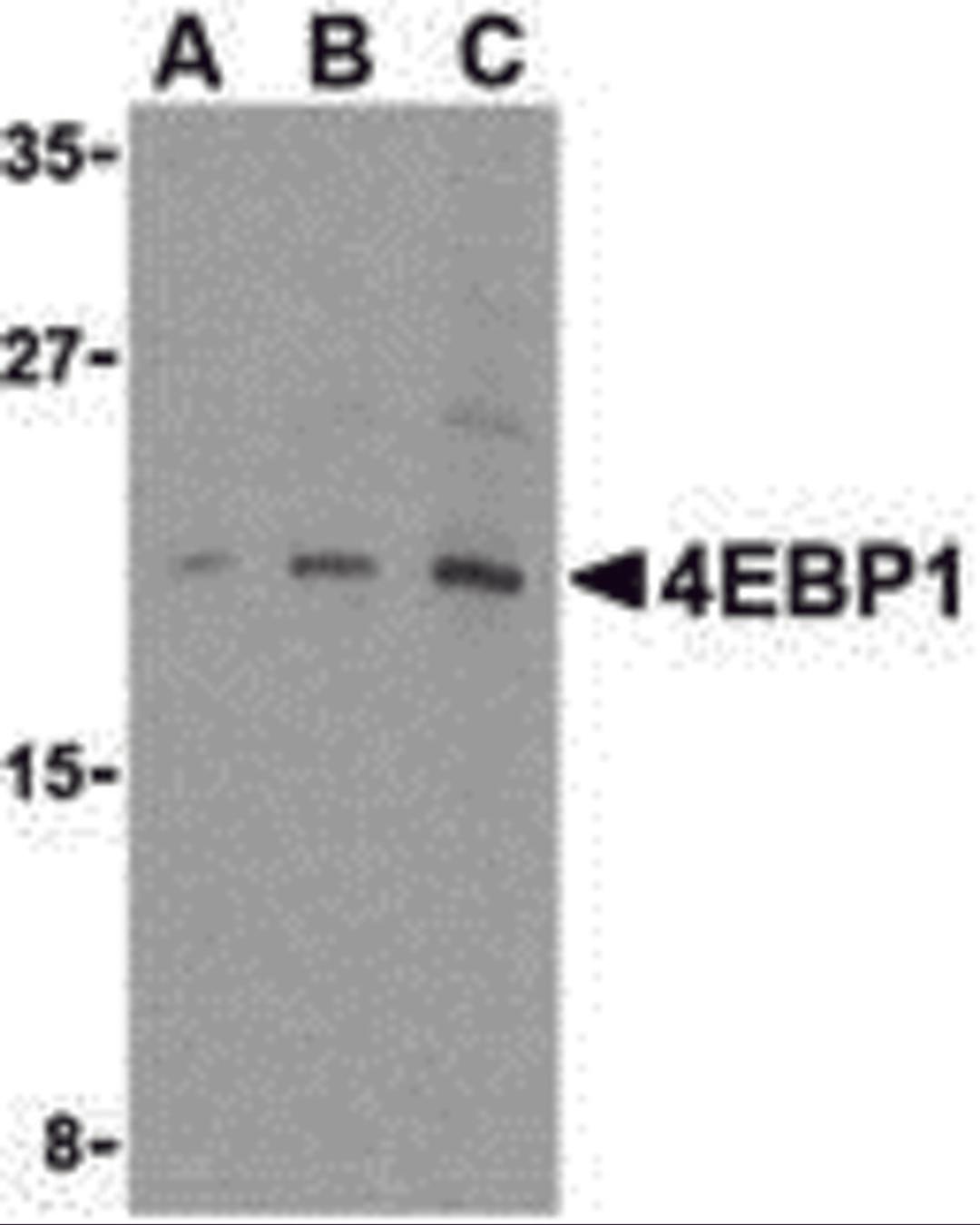 Western blot analysis of 4E-BP1 in 3T3 cell lysate with 4E-BP1 antibody at (A) 2.5, (B) 5 and (C) 10 μg/mL.