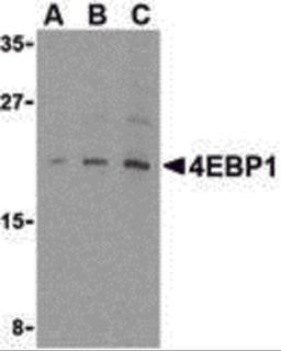Western blot analysis of 4E-BP1 in 3T3 cell lysate with 4E-BP1 antibody at (A) 2.5, (B) 5 and (C) 10 μg/mL.