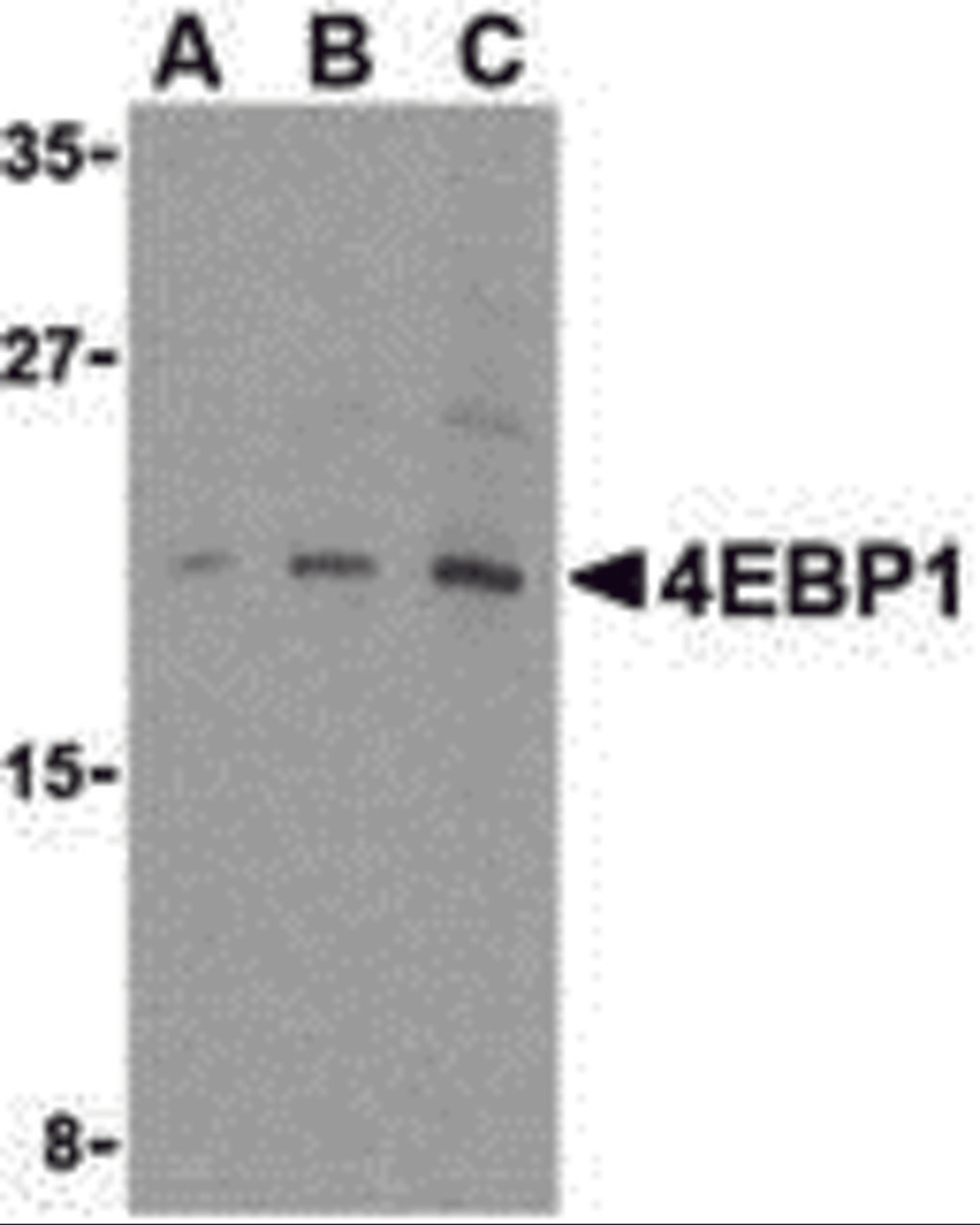 Western blot analysis of 4E-BP1 in 3T3 cell lysate with 4E-BP1 antibody at (A) 2.5, (B) 5 and (C) 10 μg/mL.