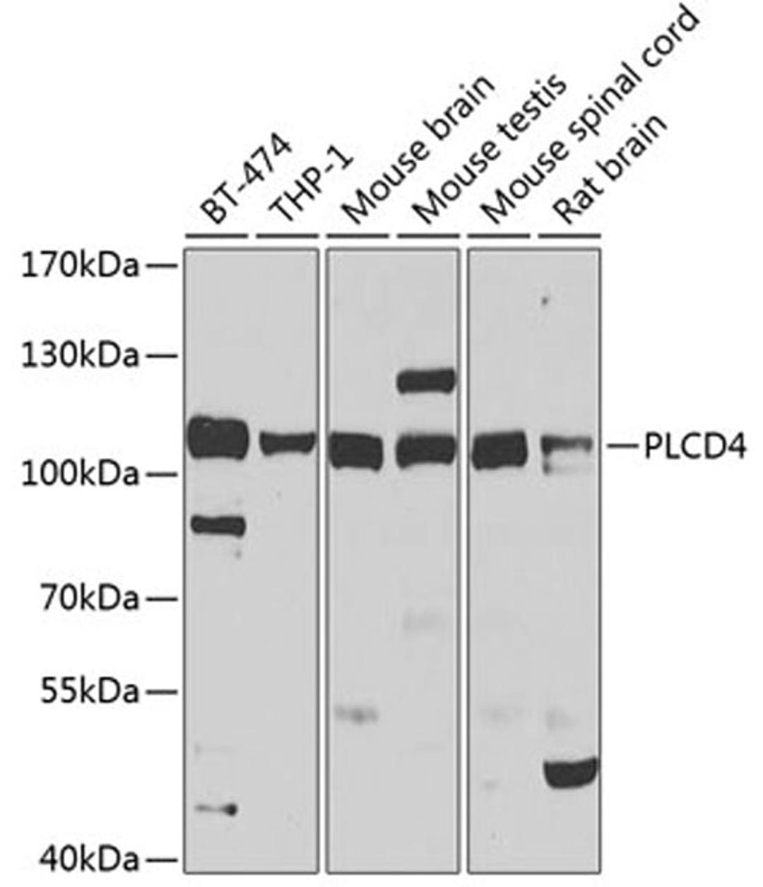 Western blot - PLCD4 antibody (A7841)