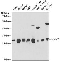 Western blot - NNMT antibody (A6673)