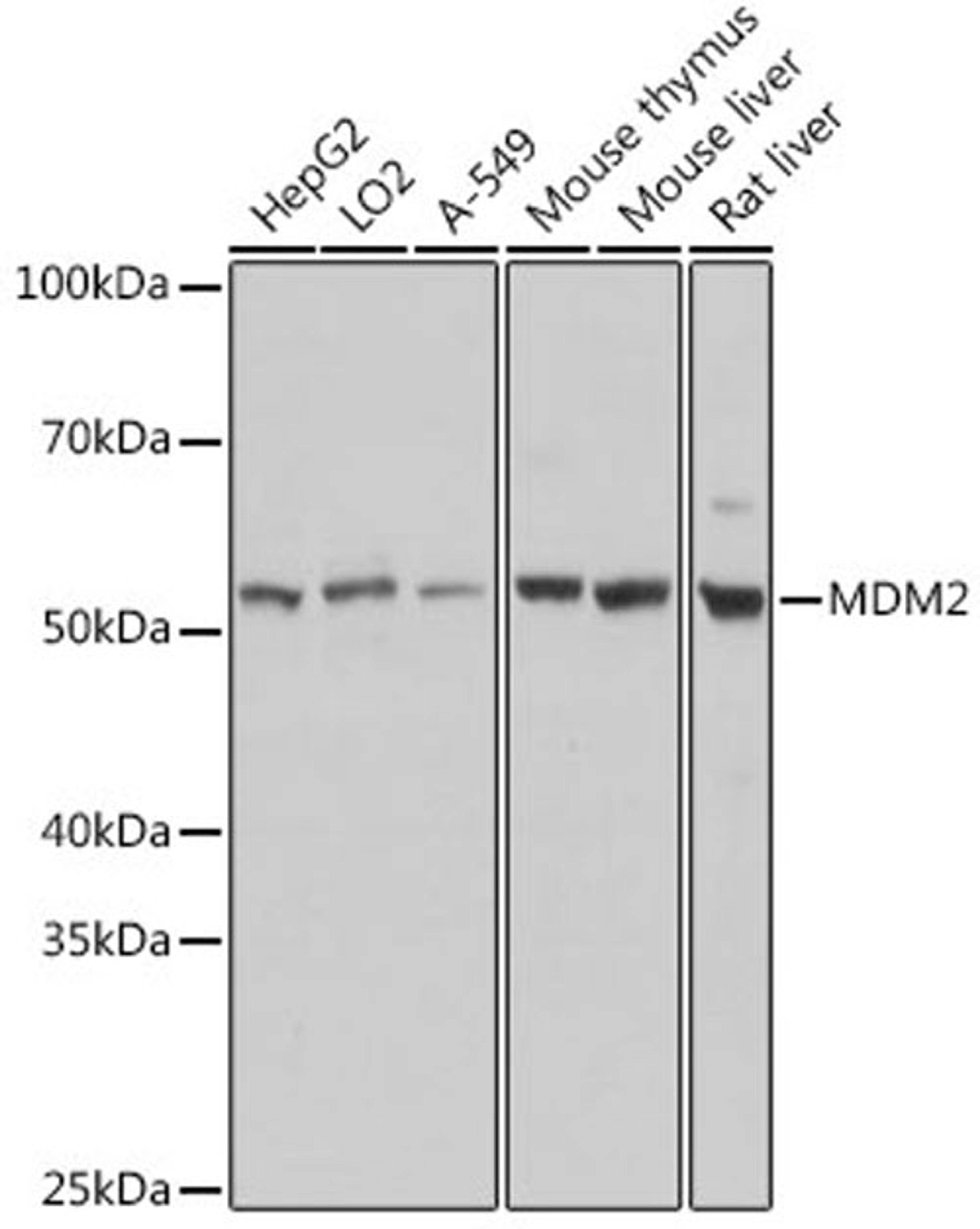 Western blot - MDM2 antibody (A13327)