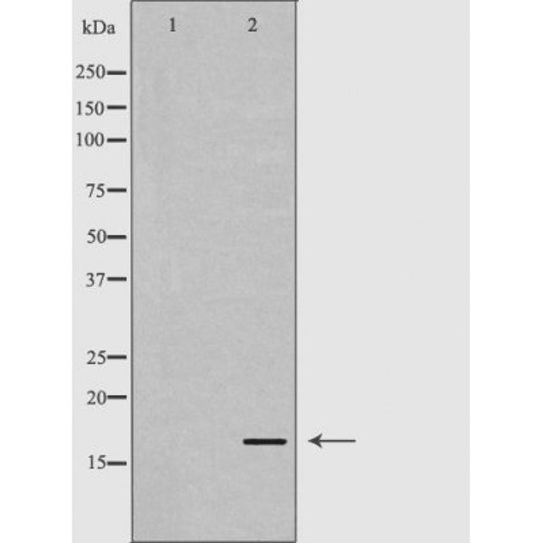 Western blot analysis of brain cell lysate using CALM3 antibody