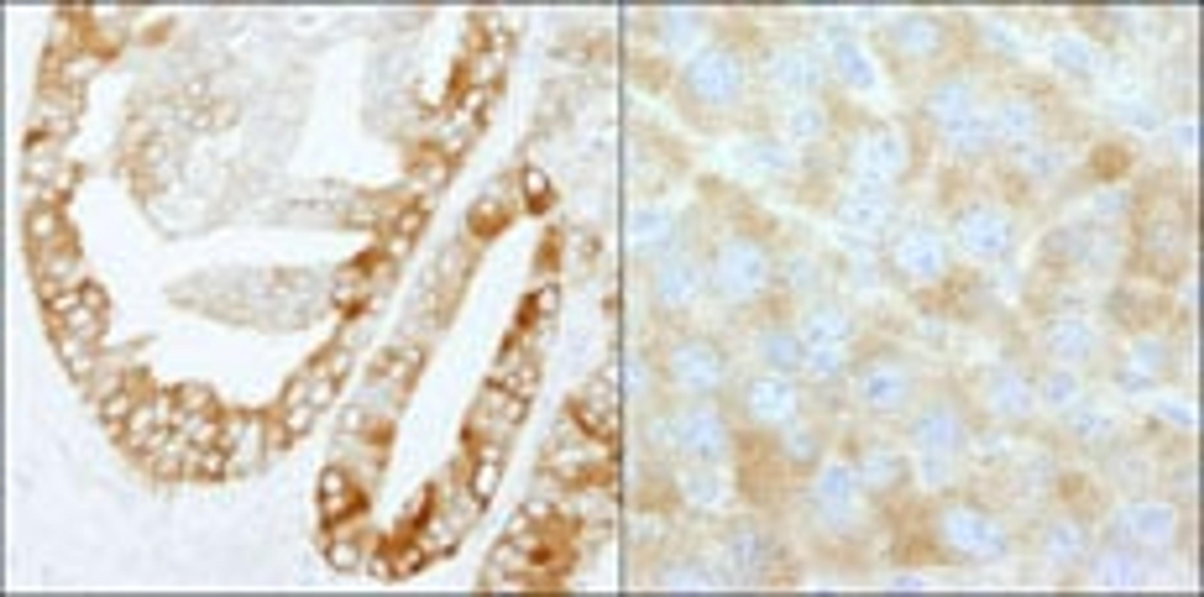 Detection of human and mouse FASN by immunohistochemistry.