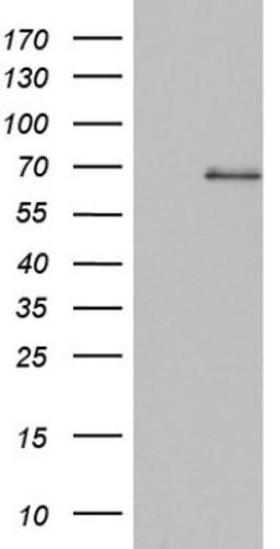 Western Blot: SMPD1 Antibody (3H7) [NBP2-45889] - Analysis of HEK293T cells were transfected with the pCMV6-ENTRY control (Left lane) or pCMV6-ENTRY SMPD1.