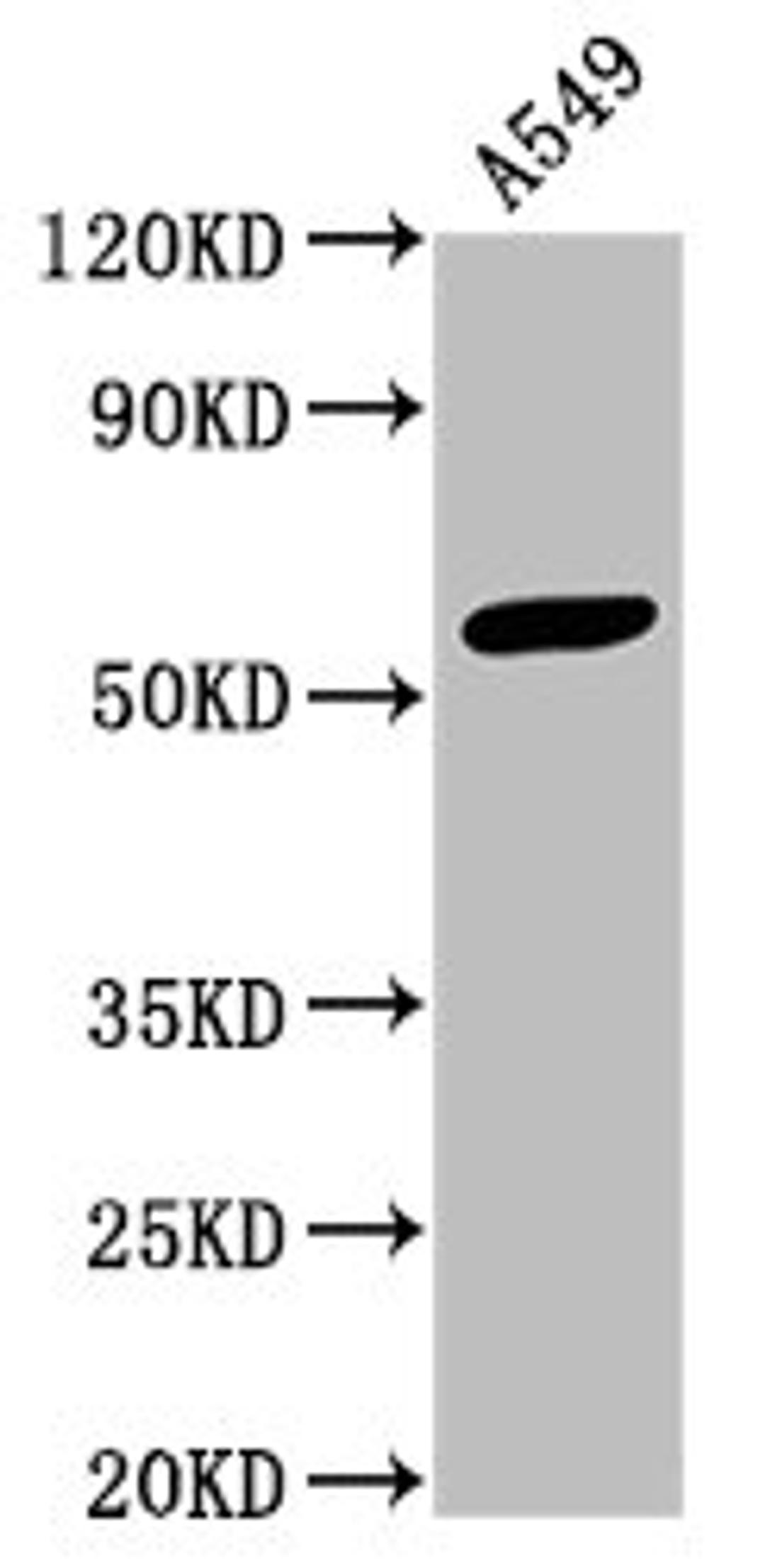 Western Blot. Positive WB detected in: A549 whole cell lysate. All lanes: IFIT3 antibody at 3.3µg/ml. Secondary. Goat polyclonal to rabbit IgG at 1/50000 dilution. Predicted band size: 56 kDa. Observed band size: 56 kDa