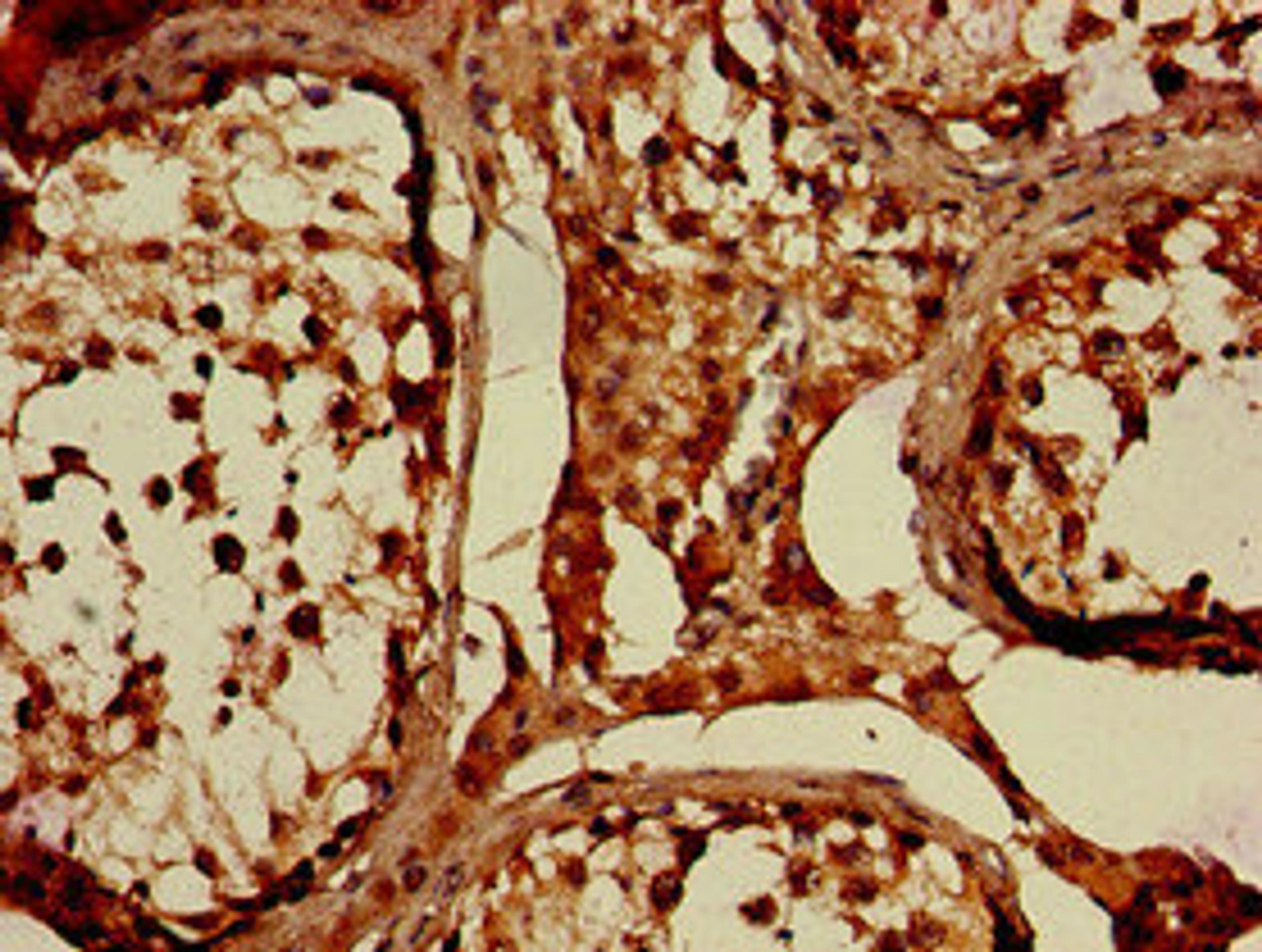 Immunohistochemistry of paraffin-embedded human testis tissue using CSB-PA887978LA01HU at dilution of 1:100
