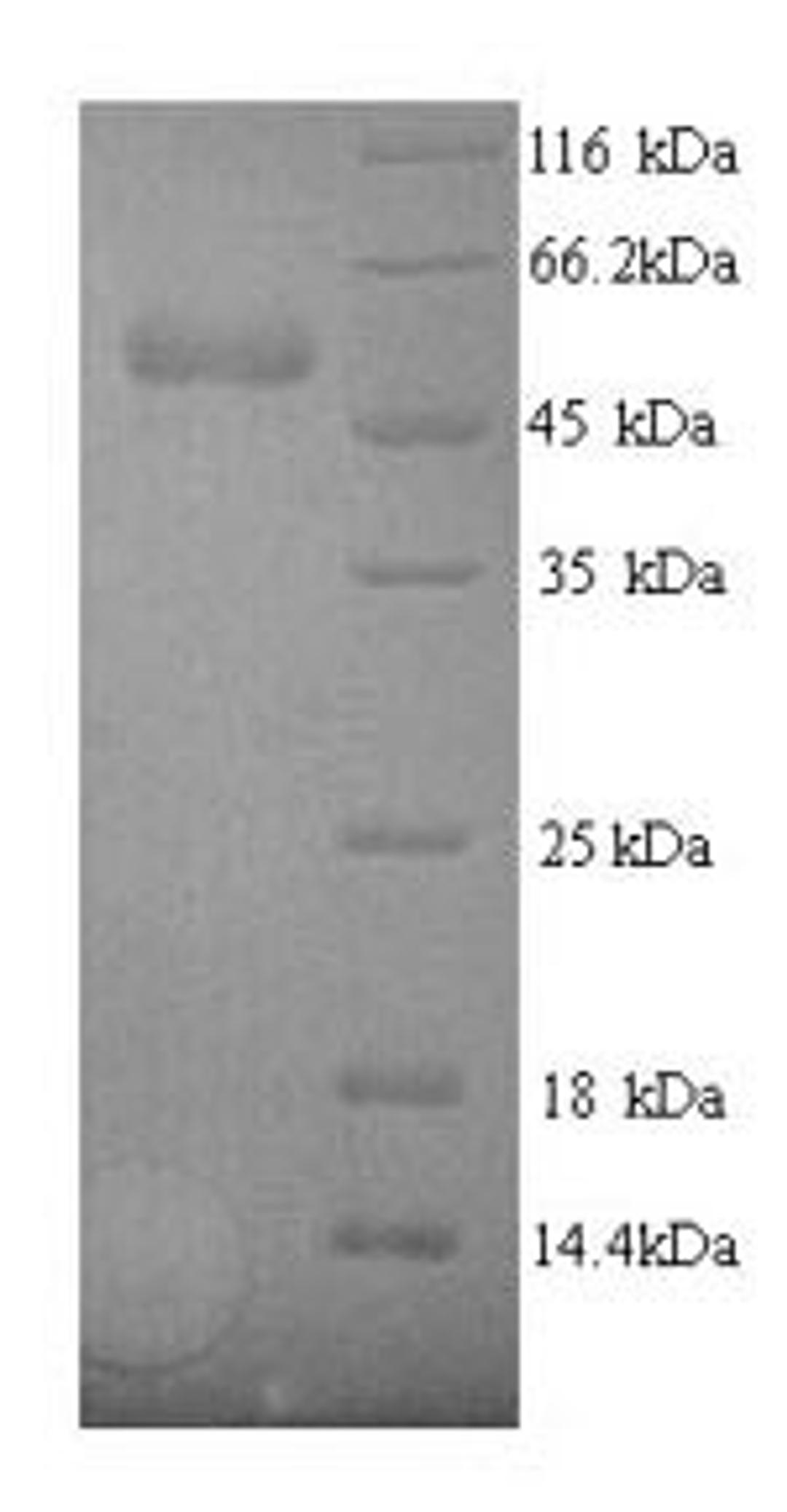 (Tris-Glycine gel) Discontinuous SDS-PAGE (reduced) with 5% enrichment gel and 15% separation gel.