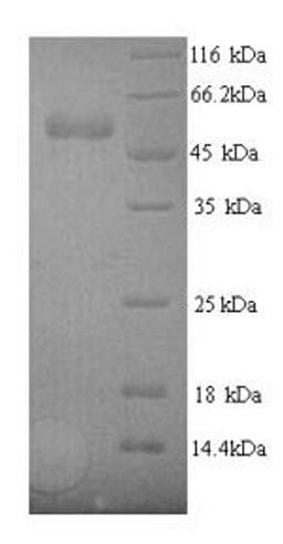 (Tris-Glycine gel) Discontinuous SDS-PAGE (reduced) with 5% enrichment gel and 15% separation gel.