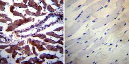 Immunohistochemistry-Paraffin: Calpastatin Antibody (2G11D6) [NB120-3515] - Biopsies of deparaffinized Human skeletal muscle tissue.