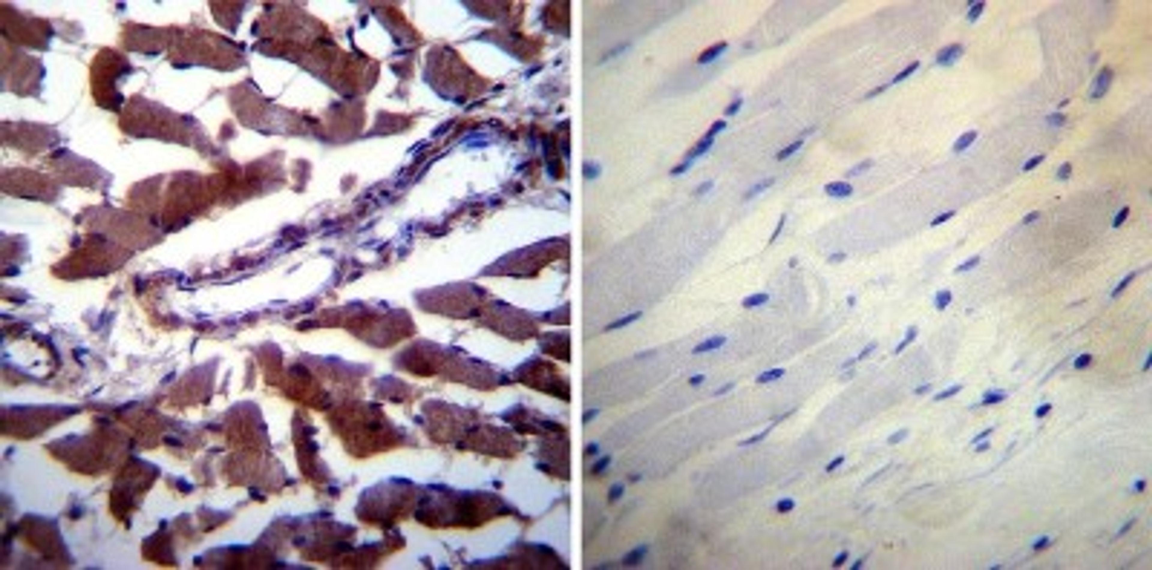 Immunohistochemistry-Paraffin: Calpastatin Antibody (2G11D6) [NB120-3515] - Biopsies of deparaffinized Human skeletal muscle tissue.