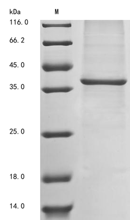 (Tris-Glycine gel) Discontinuous SDS-PAGE (reduced) with 5% enrichment gel and 15% separation gel.