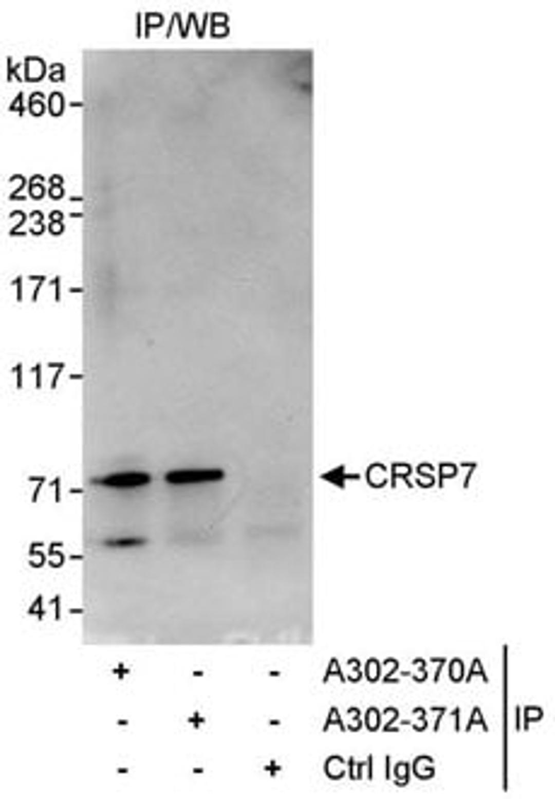 Detection of human CRSP7 by western blot of immunoprecipitates.