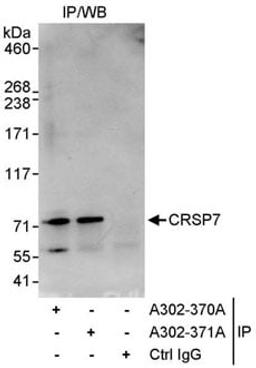 Detection of human CRSP7 by western blot of immunoprecipitates.