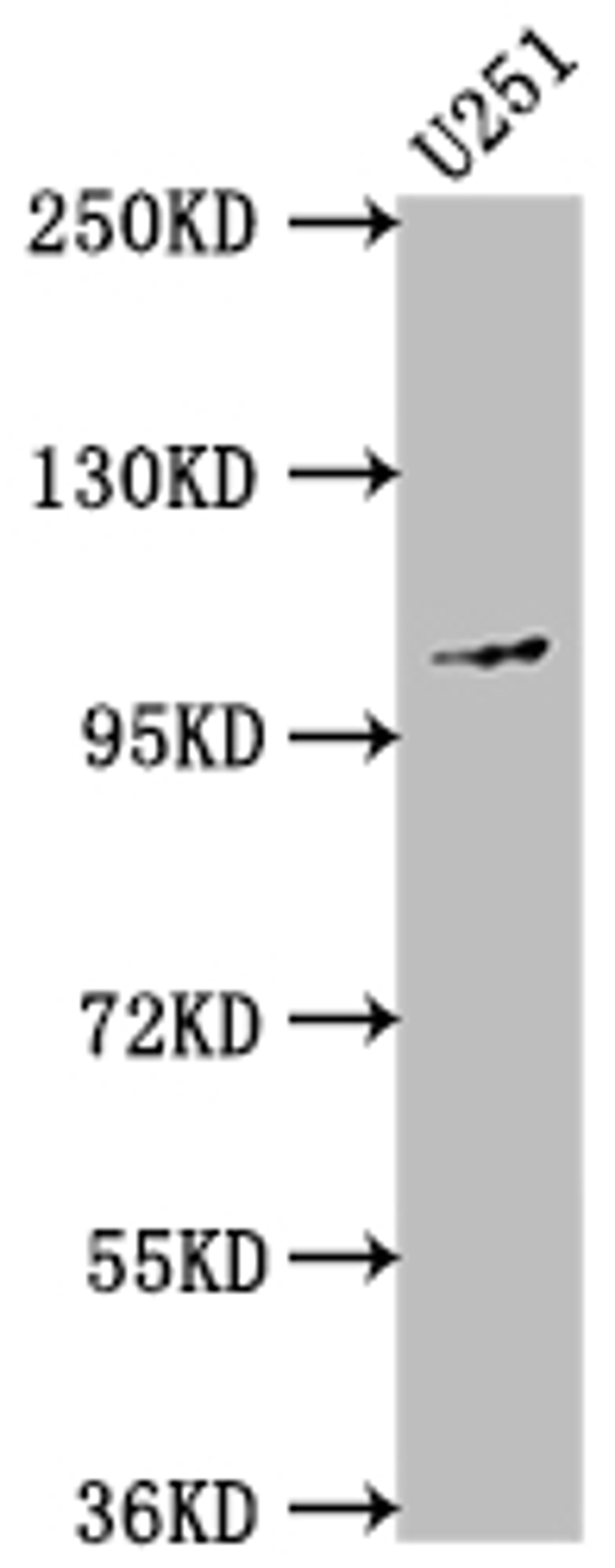 Western Blot. Positive WB detected in: U251 whole cell lysate. All lanes: MME antibody at 1:1500. Secondary. Goat polyclonal to rabbit IgG at 1/50000 dilution. Predicted band size: 86 kDa. Observed band size: 100 kDa.