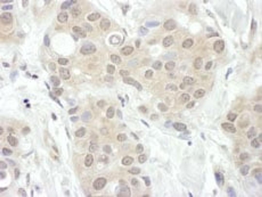 Detection of human FIH-1 by immunohistochemistry.