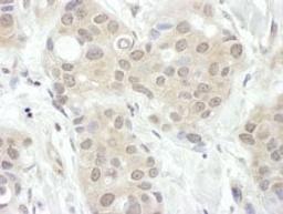 Detection of human FIH-1 by immunohistochemistry.