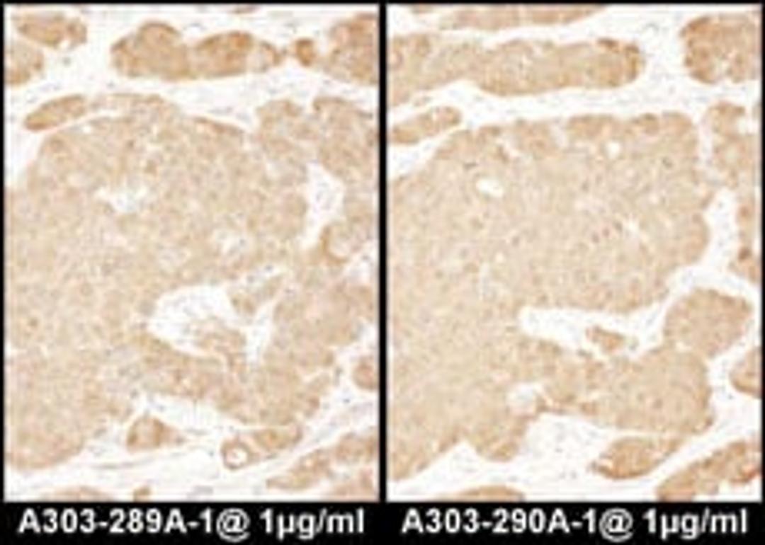 Detection of human LASP1 by immunohistochemistry.