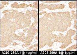 Detection of human LASP1 by immunohistochemistry.