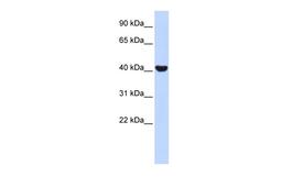 Antibody used in WB on Human Fetal Muscle at 1 ug/ml.