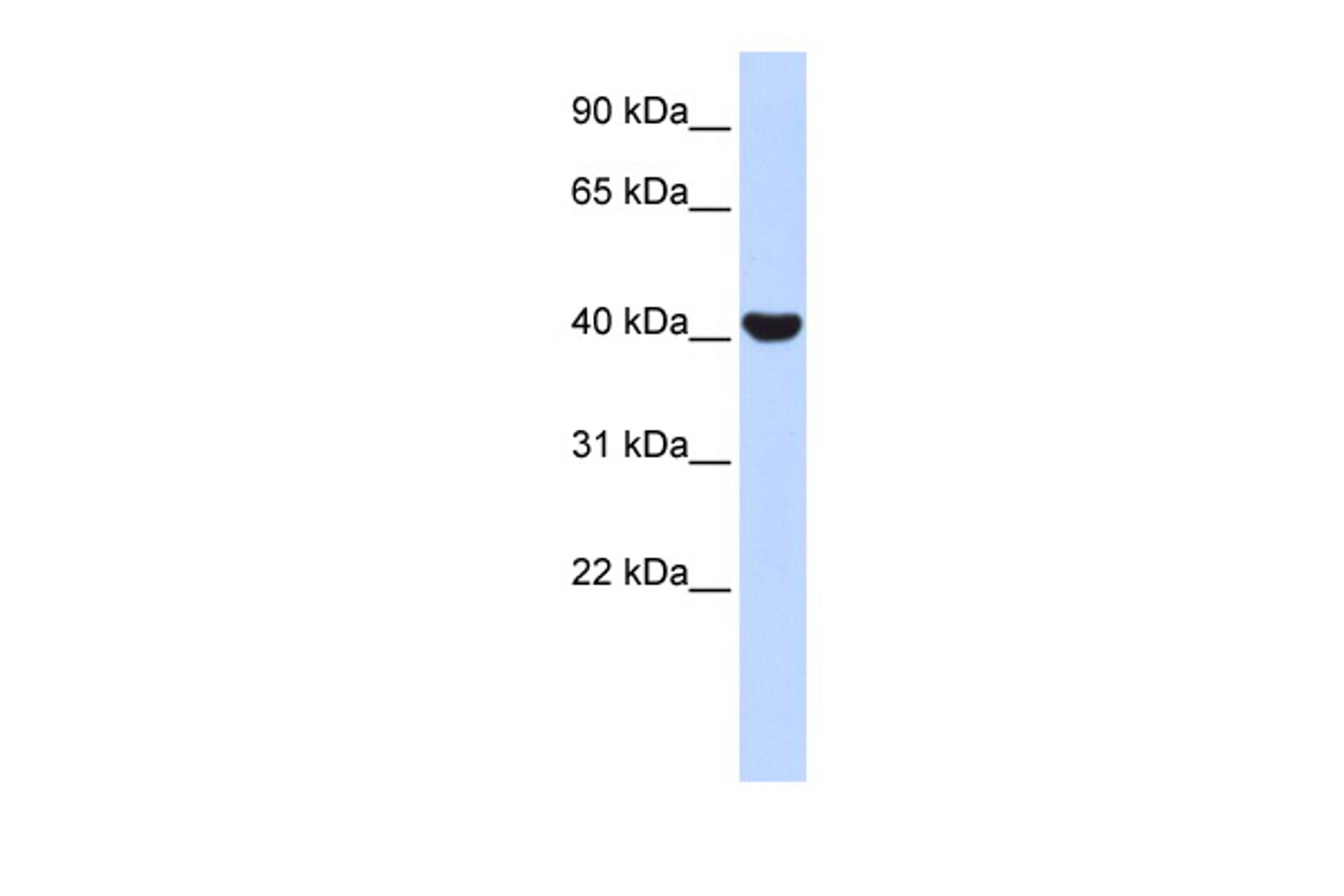 Antibody used in WB on Human Fetal Muscle at 1 ug/ml.