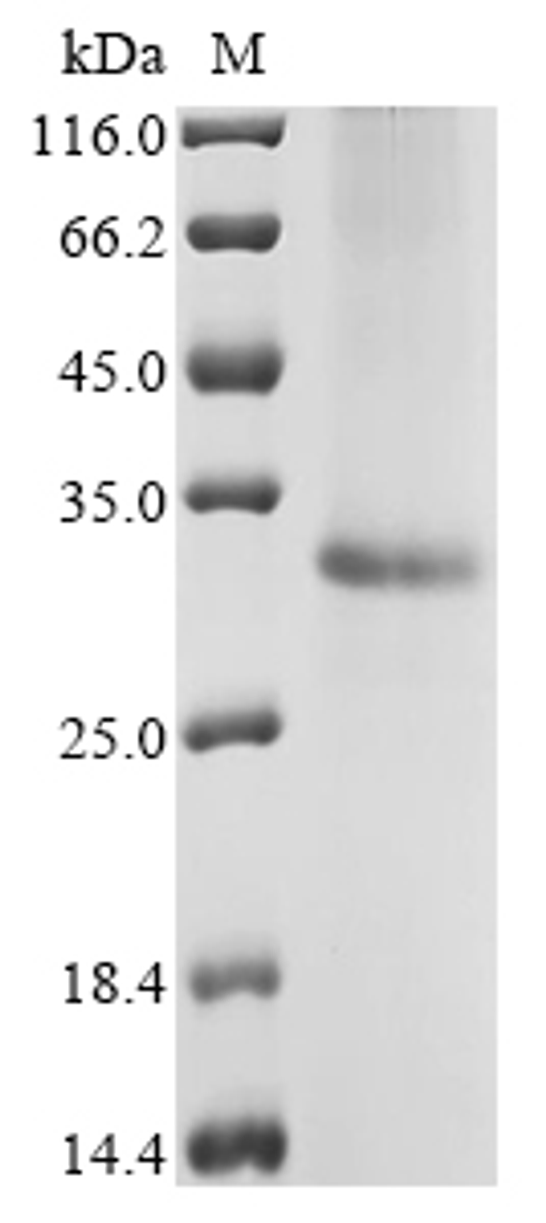 (Tris-Glycine gel) Discontinuous SDS-PAGE (reduced) with 5% enrichment gel and 15% separation gel.