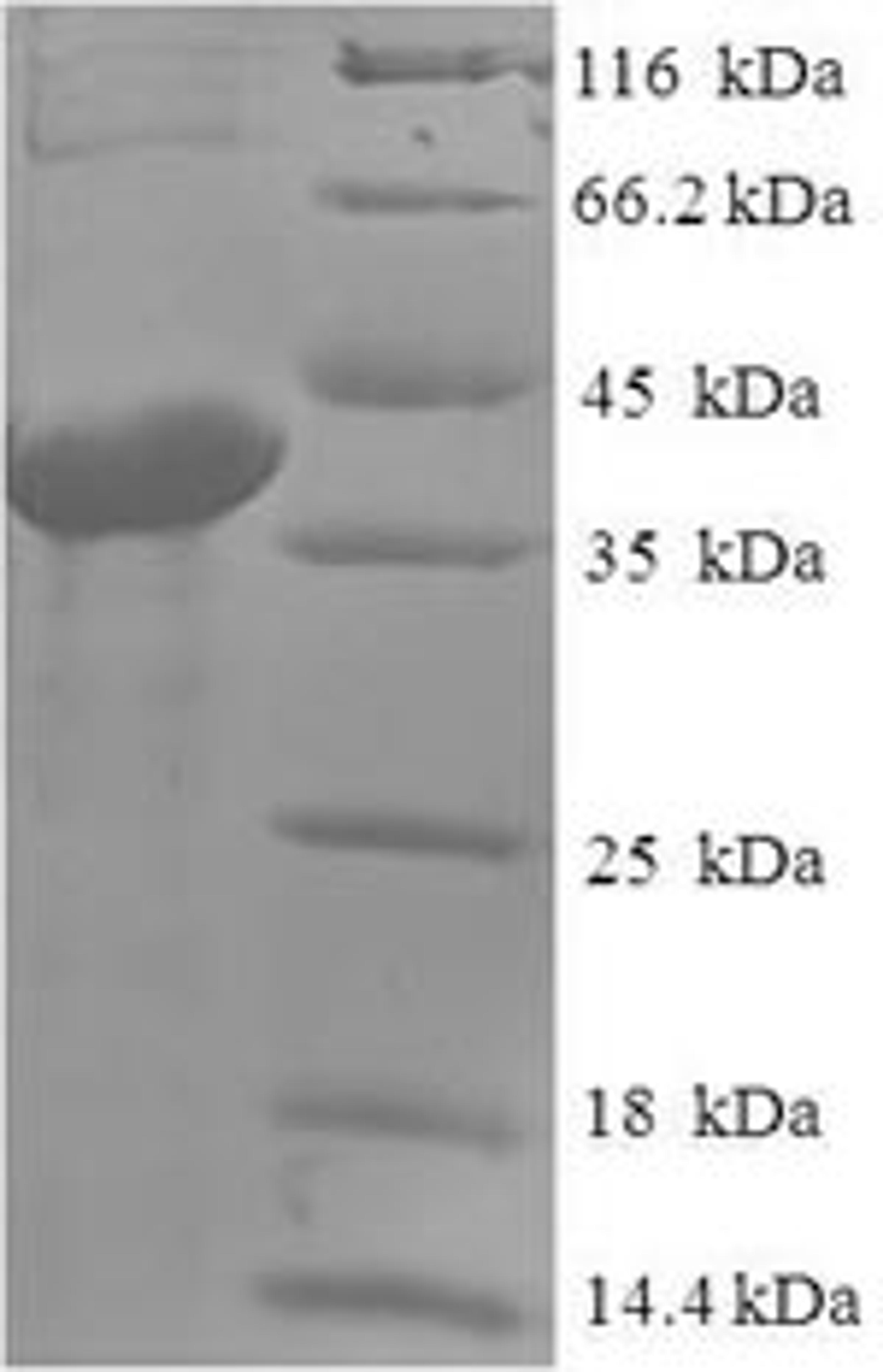 (Tris-Glycine gel) Discontinuous SDS-PAGE (reduced) with 5% enrichment gel and 15% separation gel.