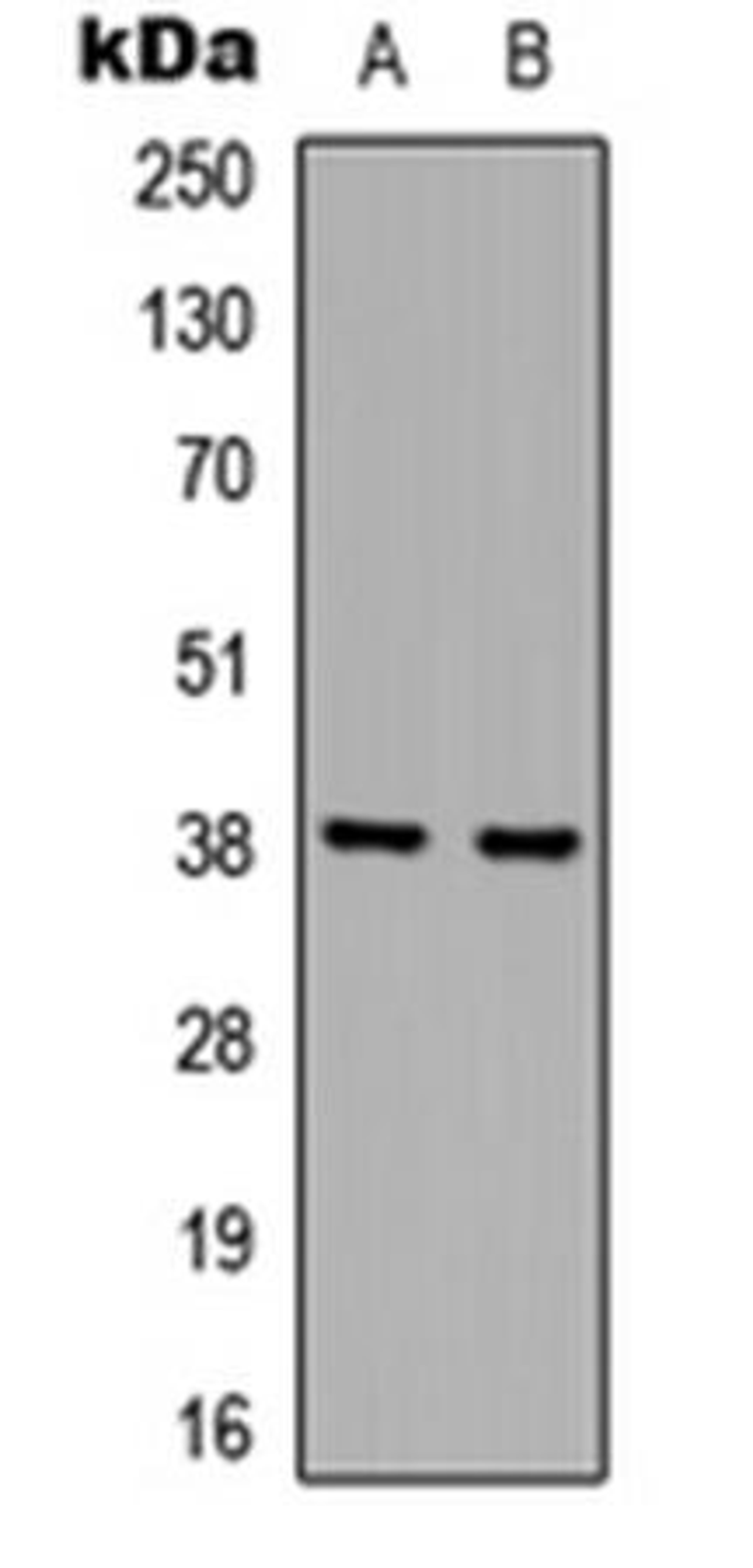 Western blot analysis of A431 (Lane1), Jurkat (Lane2) whole cell using hnRNP D0 antibody