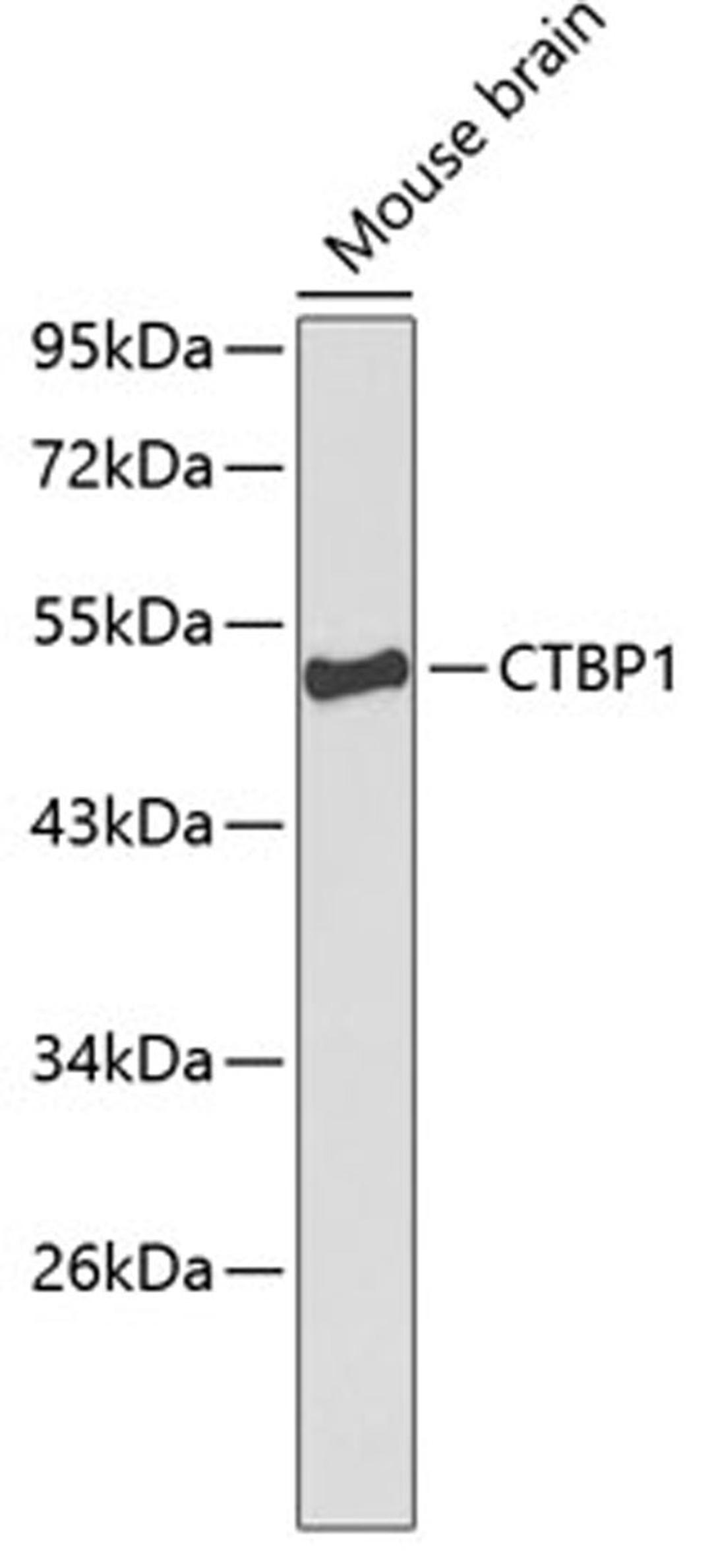 Western blot - CTBP1 Antibody (A1707)