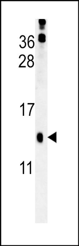 Western blot analysis in mouse kidney tissue lysates (15ug/lane).This demonstrates the detected HRASLS3 protein (arrow).