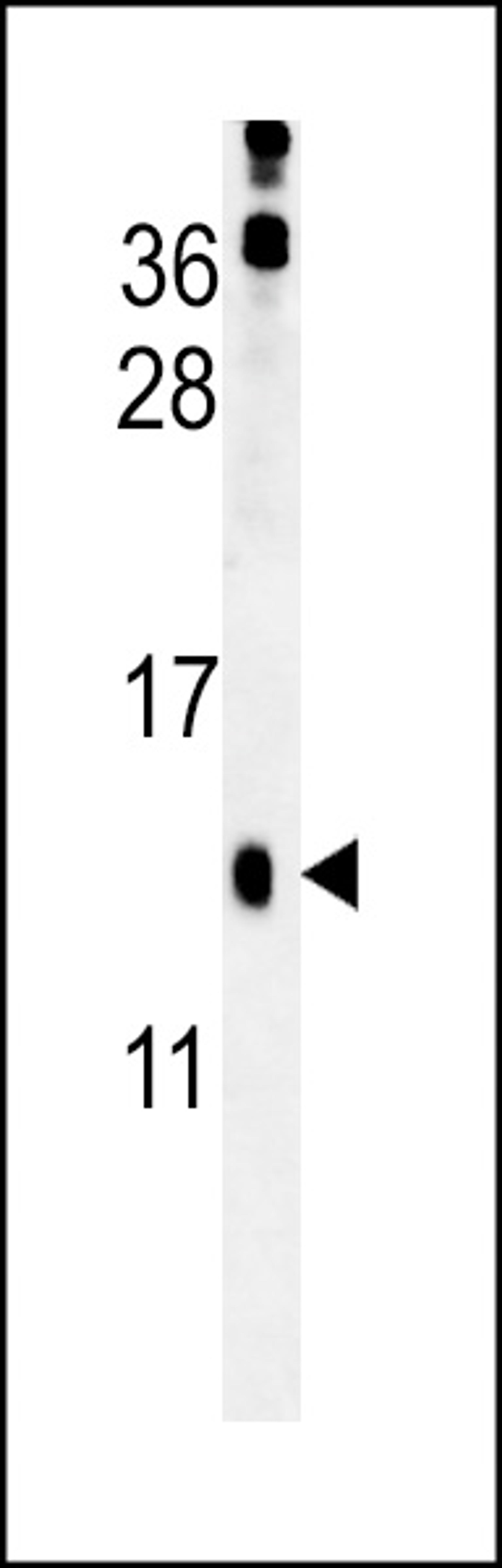 Western blot analysis in mouse kidney tissue lysates (15ug/lane).This demonstrates the detected HRASLS3 protein (arrow).