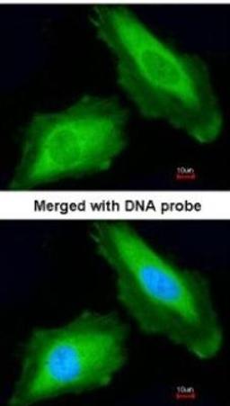 Immunocytochemistry/Immunofluorescence: DDX3Y Antibody [NBP1-32780] - Paraformaldehyde-fixed HeLa, using antibody at 1:200 dilution.