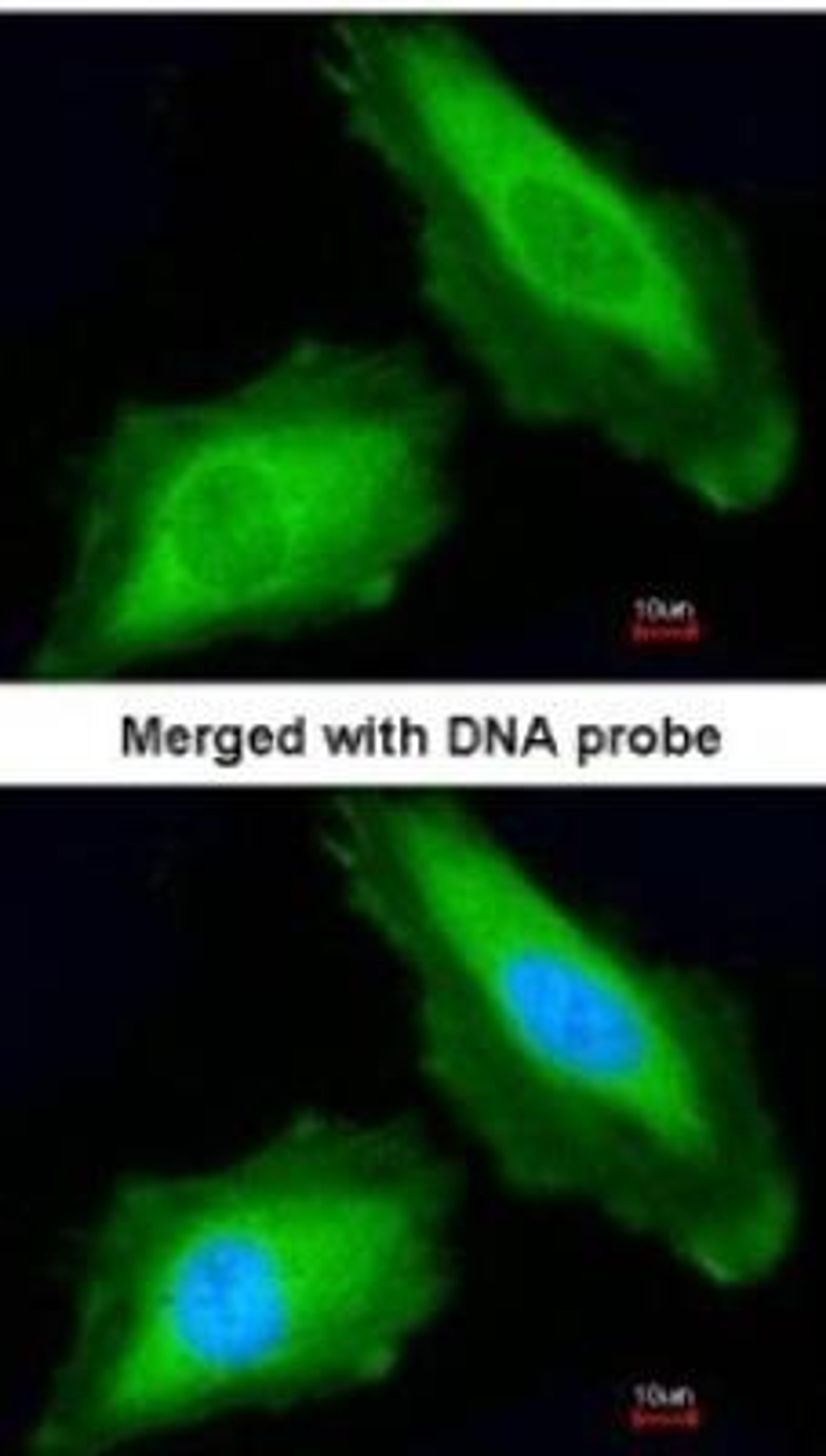 Immunocytochemistry/Immunofluorescence: DDX3Y Antibody [NBP1-32780] - Paraformaldehyde-fixed HeLa, using antibody at 1:200 dilution.