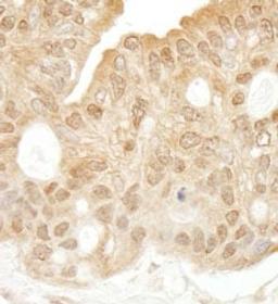 Detection of human SYK by immunohistochemistry.