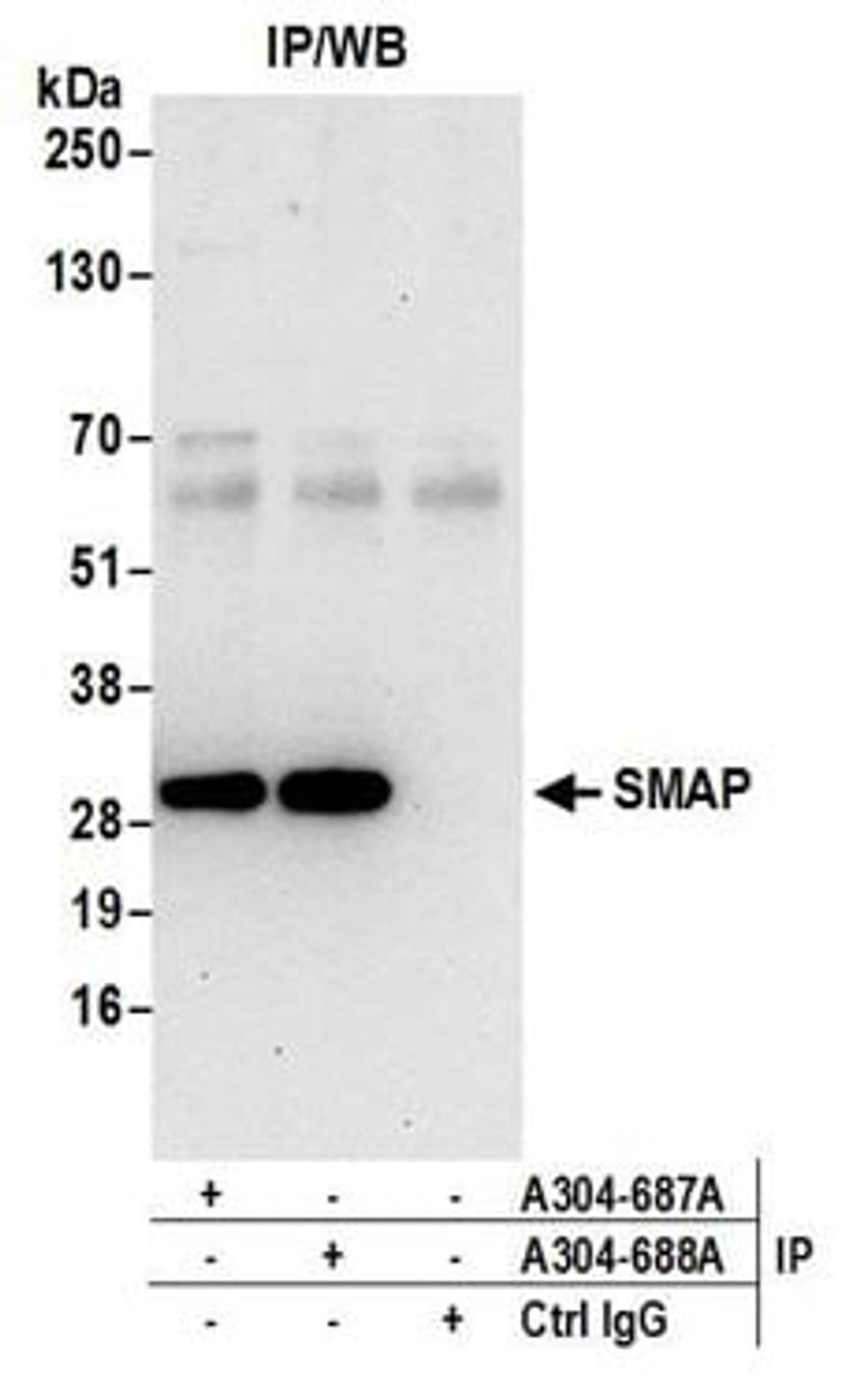 Detection of human SMAP by western blot of immunoprecipitates.